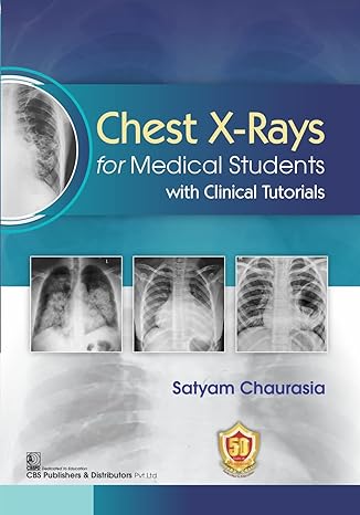 Chest X Rays For Medical Students With Clinical Tutorials (Pb 2023)